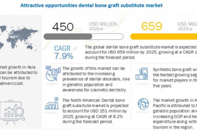 Dental Bone Graft Substitute Market Worth USD 659 million by 2025 : Continuous Product Commercialization