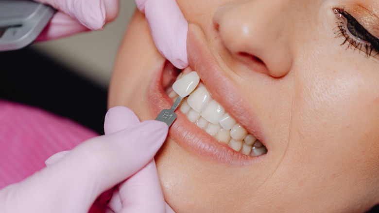 How Braces Work