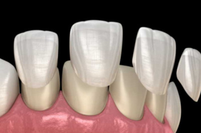 Benefits of Tooth Countering Services in Greenville