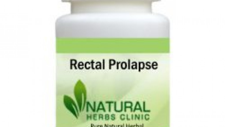 Herbal Treatment for Rectal Prolapse | Natural Remedies | Natural Herbs Clinic
