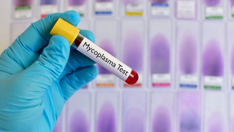 Mycoplasma Testing Market Development Analysis 2019 to 2027