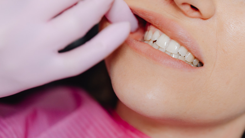 Retainer Cost in Nepal