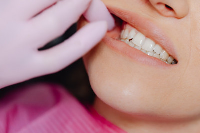 Retainer Cost in Nepal