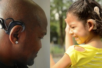 Cochlear Implants Market Growth Statistics,Size, SWOT Analysis, Forthcoming Developments, Upcoming Investments and Forecast 2019 - 2027