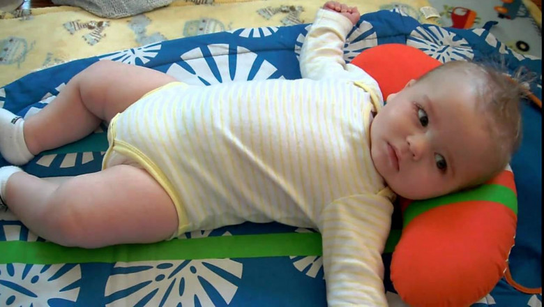 Is Infantile Spasm Treatment a life-threatening condition?