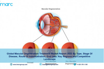 Macular Degeneration Treatment Market Size, Share, Industry Growth, Trends, Analysis, Demand and Forecast by 2027
