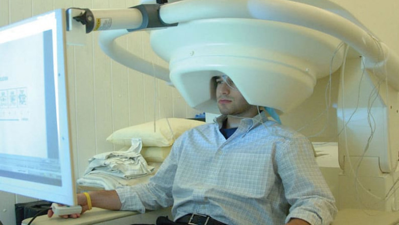 What is the total number of Magnetoencephalography Devices?