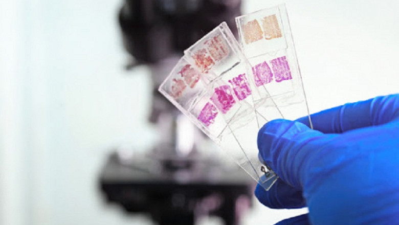 Anatomic Pathology Market Size, Development, Share and Forecast to 2026 with Covid19 Impact | Agilent Technologies, Inc (U.S.), Sakura Tech (Singapore)