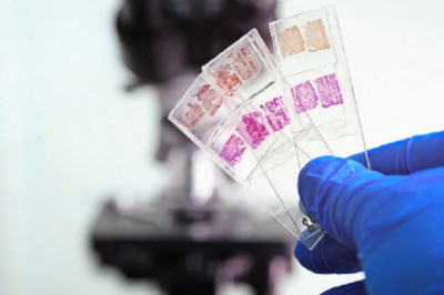 Anatomic Pathology Market Size, Development, Share and Forecast to 2026 with Covid19 Impact | Agilent Technologies, Inc (U.S.), Sakura Tech (Singapore)