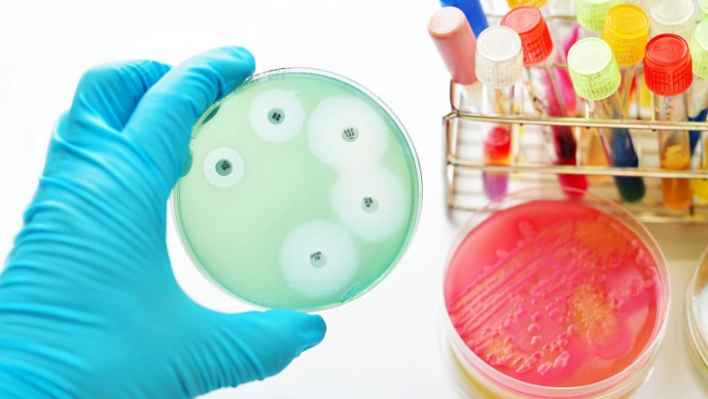 Antimicrobial Susceptibility Testing Market Trends, Key Players, Overview by Product Type, Methods, Type Forecast By 2029