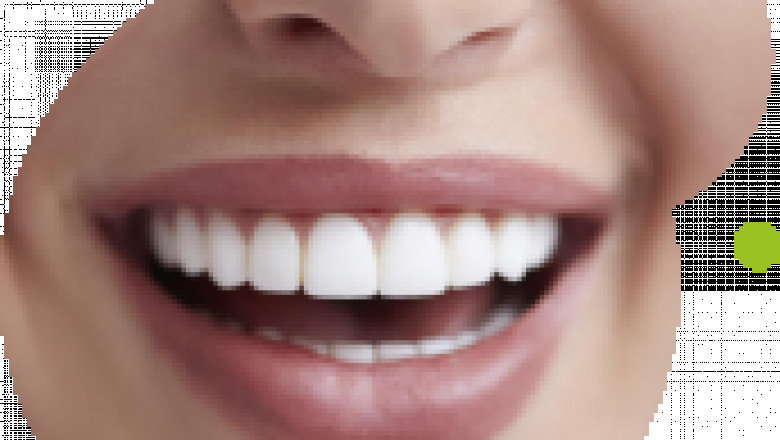 The amount Do Invisible Braces Cost?