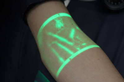 Vein illuminator Market Forecast - Global Industry Growth and Analysis – 2027
