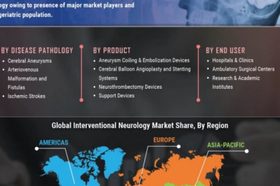 Interventional Neurology Market Status, Emerging Technologies, Future Plans and Trends by Forecast 2027