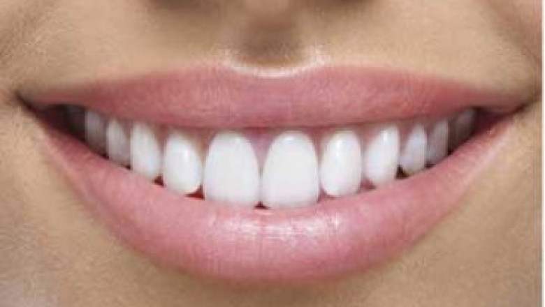 Voted Top Orthodontist in Orlando | Hamlin & Lake Nona | Sakowitz Smiles Orthodontics | Invisalign & Braces
