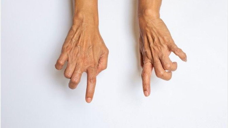 Muscle Spasticity Market Huge Growth in Future Scope 2022-2028 | Ipsen Pharma, Allergan, Acorda Therapeutics, Inc., Merz Pharma, Teva Pharmaceutical Industries Ltd.