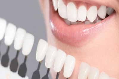 The Benefits of Professional Tooth Whitening | Tower House Dental Clinic