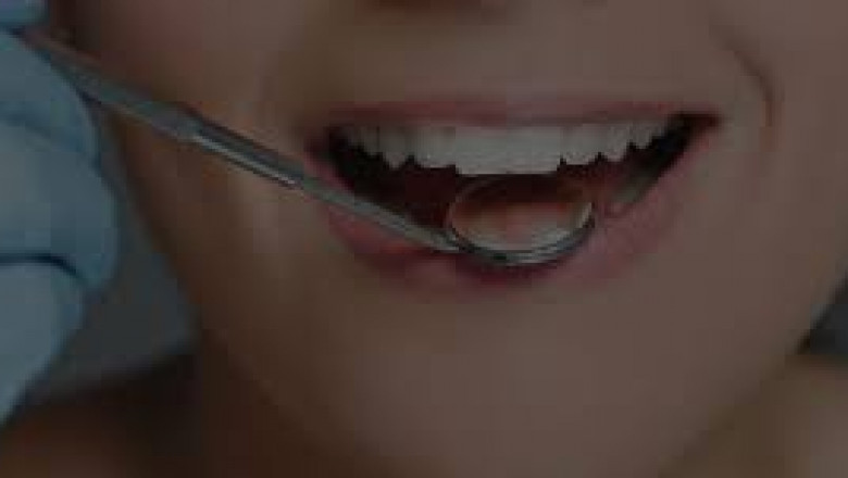 What Are The Most Frequently Asked Questions About Dentures?