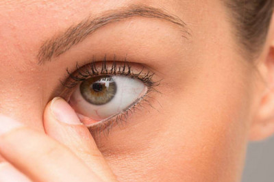 Blepharitis Treatment; Patients Need to Maintain A Good Hygiene Regimen to Prevent Recurrences