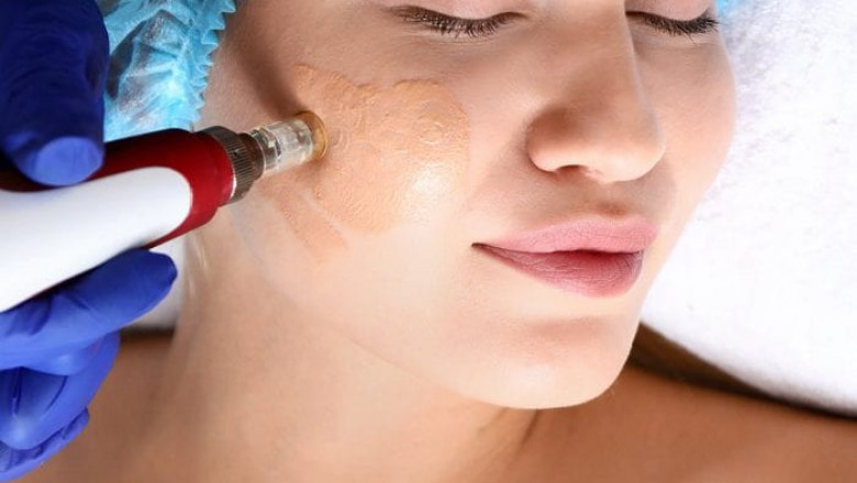 The Basics You Need To Know About Eyebrow Tattooing