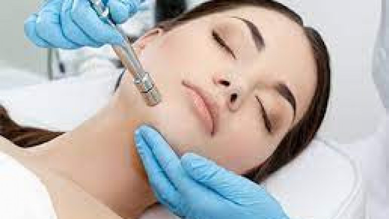 Best Laser Resurfacing Treatment Price In Hyderabad