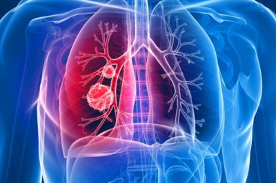 Cushing’s Syndrome Market Regional Analysis