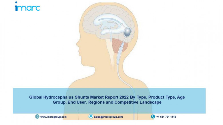 Hydrocephalus Shunts Market Size, Growth, Trends and Forecast 2022-27