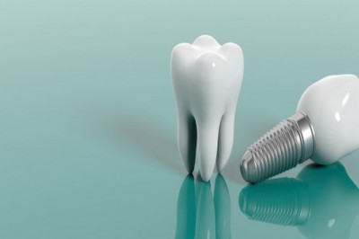 Dental Implants Treatment: Indications And Contraindications