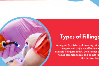 How Long do Fillings Take for Tooth Cavities? | Top Emergency Dentists