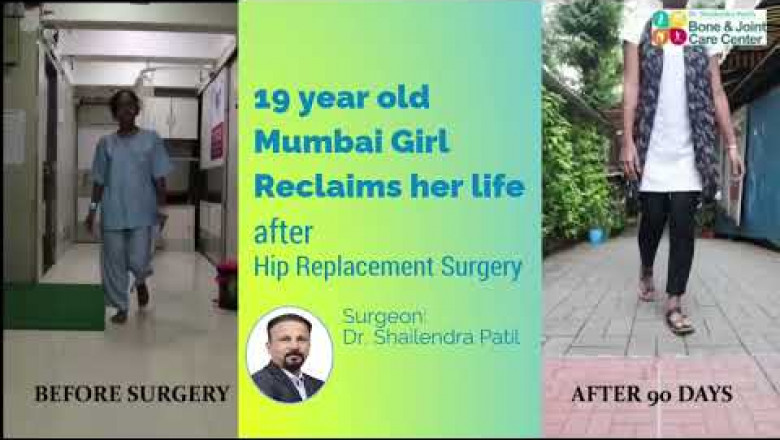 19 Year old Girl Meetali Gawade Reclaims life After Anatomical Hip Replacement Surgery Mulund || Dr. Shailendra Patil