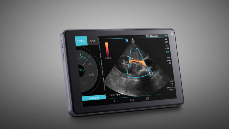 In 2019, the global ultrasound devices market is expected to reach $6,230.1 million, and the CAGR is expected to be 1.9% during the forecast period (2020 – 2027).