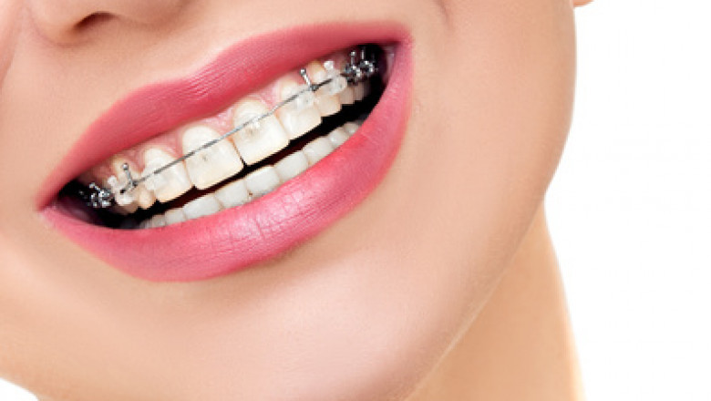 What are the treatments provided by the best Bensonhurst Orthodontist?