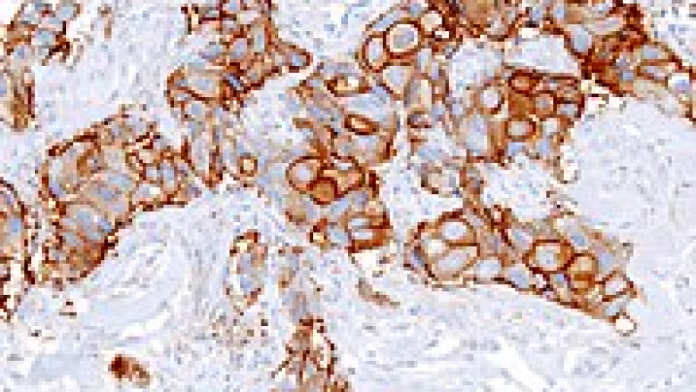 Anatomic Pathology Market Share, Growth, Statistics, by Application, Production, Revenue & Forecast