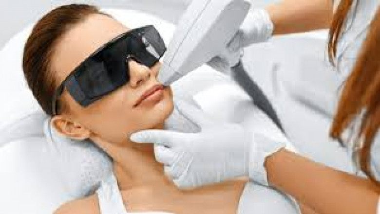 Top Things to Know Before Getting Laser Hair Removal