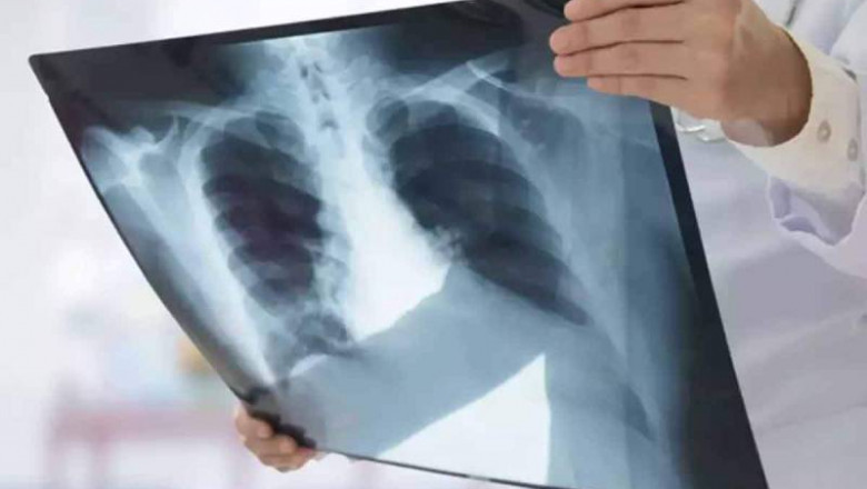 Digital X-Ray | Megavision Diagnostics Centres