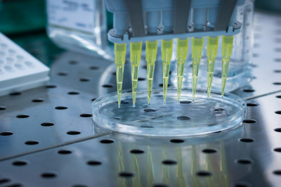 Multiplex Assays Market Report Forecast 2022-2030 By Price, Trend, and Growth
