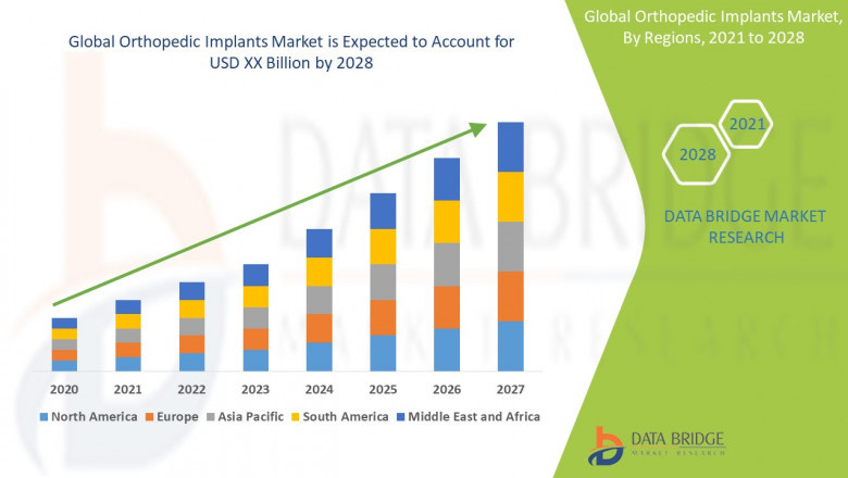 Orthopedic Implants Market Share, Trends, Growth, Segments, Insights & Forecast by 2028 - Globus Medical, Medtronic, Integra LifeSciences Corporation