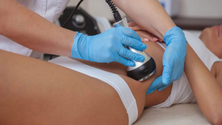 Ultrasonic Cavitation and Localized Fat Removal