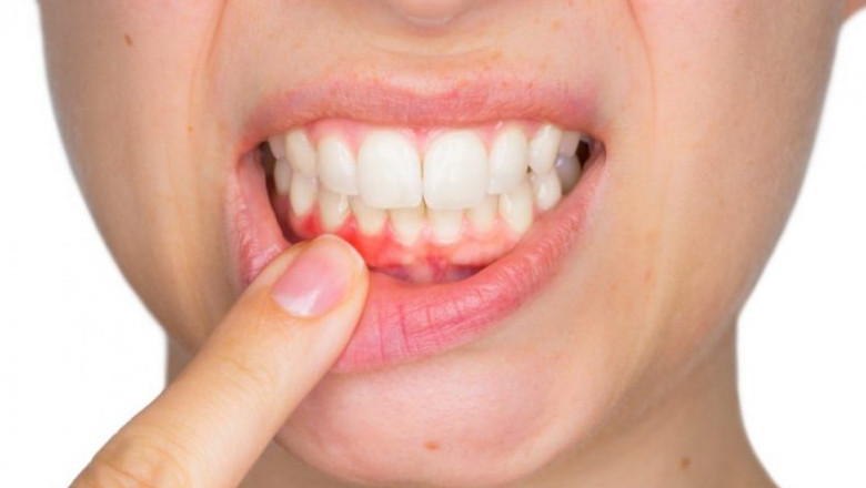 How Long Does A Tooth Extraction Take?