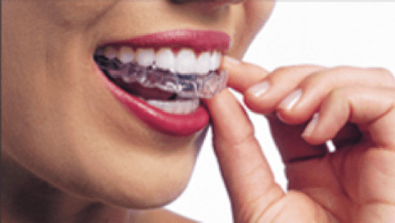 How To Choose dental implants and get The Best Out of Your Treatment