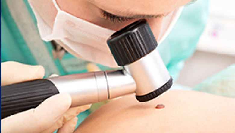 Best Skin cancer treatment in India