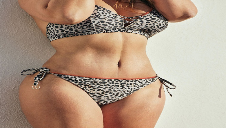 What Are The Most Frequently Asked Questions About Tummy Tuck Surgery?