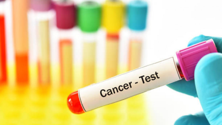 Carcinoembryonic Antigen Market 2022 Industry Trends, Share, Size, Opportunities and Growth Forecast 2027