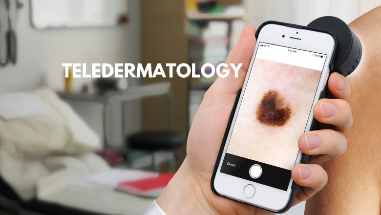 Teledermatology Specializes In Real-Time Or Live Interactive Applications