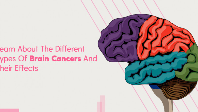 Different Types Of Brain Cancers, Effects & Treatments