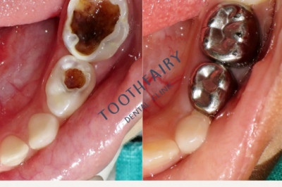 Getting the top Dental Clinic: Essential Issues to consider