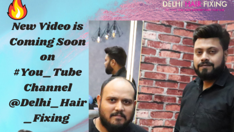 Non surgical hair replacement | Hair patch for men | Hair patch