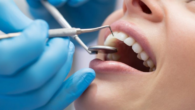 Online dental video consultation Bangalore