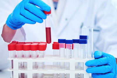 The Best Pathology Lab in Pimpri Chinchwad | Megavision Diagnostics Centres