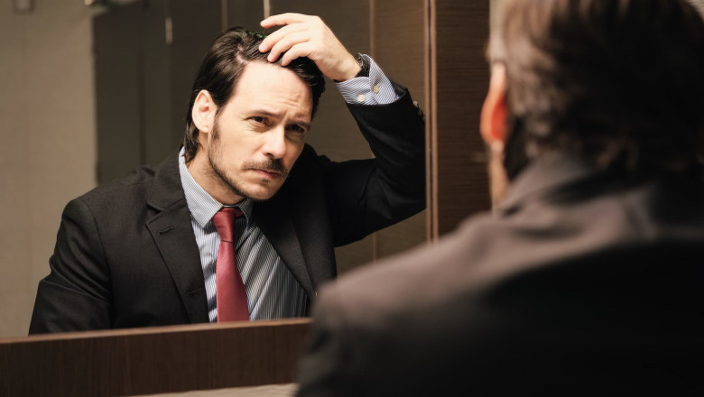 Aging hair loss.