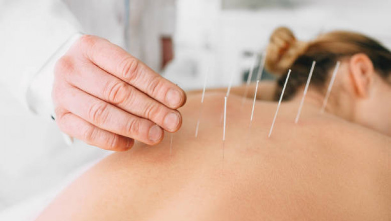 Acupuncture Market Scenario, Global Analysis By International Prestigious Players, Industry Demand and Trends by Forecast 2027